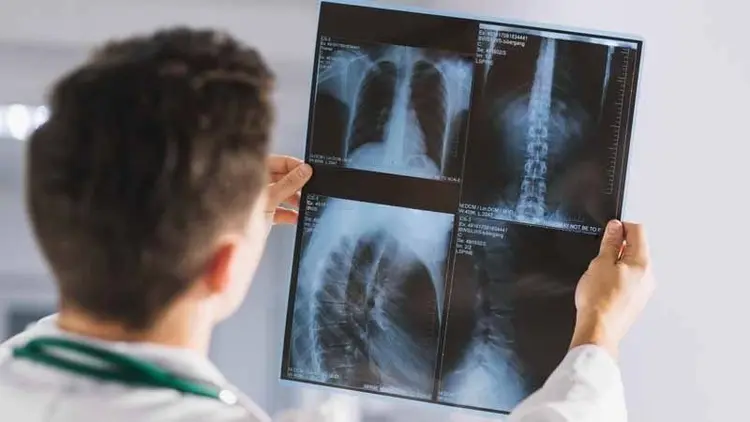 Bone mineral density testing at Healthwise Diagnostics