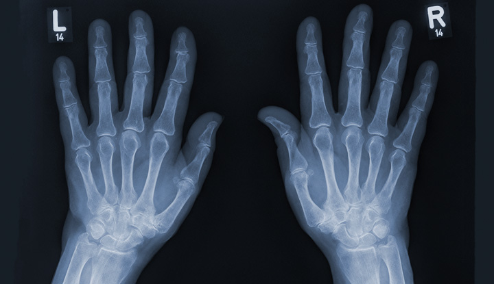 X-ray diagnostic imaging service